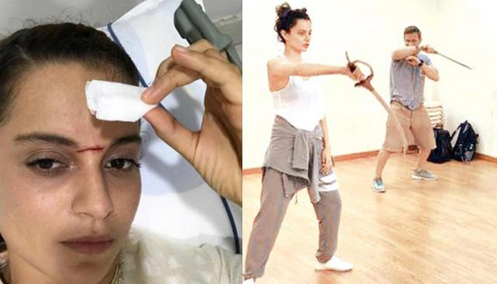 शूटिंग के दौरान घायल हुई कंगना, माथे पर लगे 15 टांके
